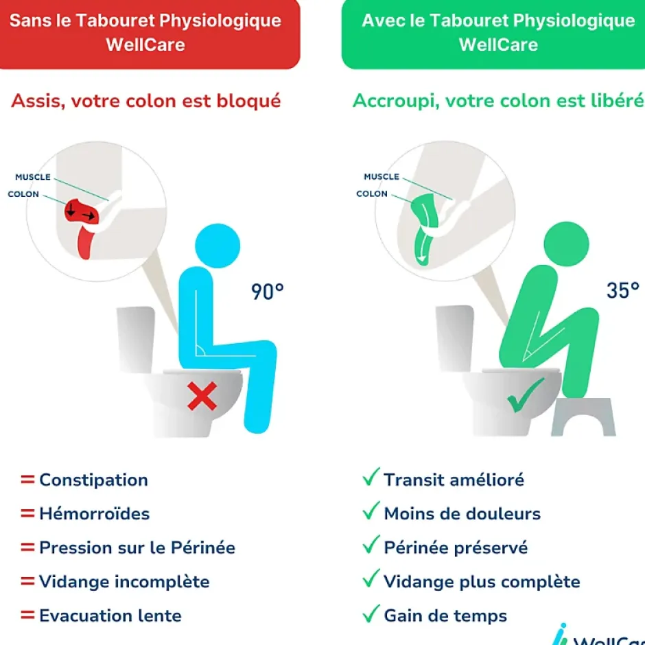 Jacob Delafon WC à poser sans bride sortie horizontale Struktura avec abattant + Tabouret physiologique blanc